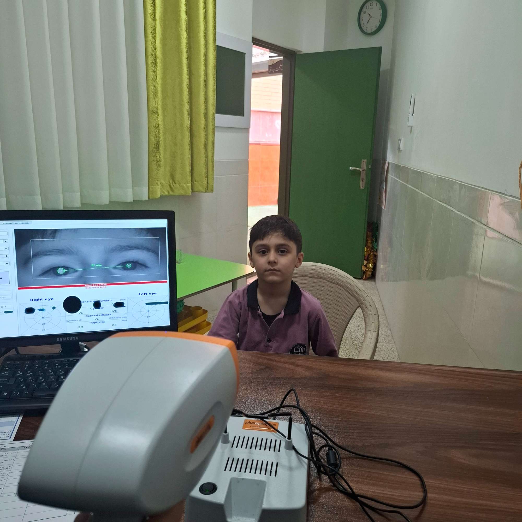 معاینه تنبلی چشم